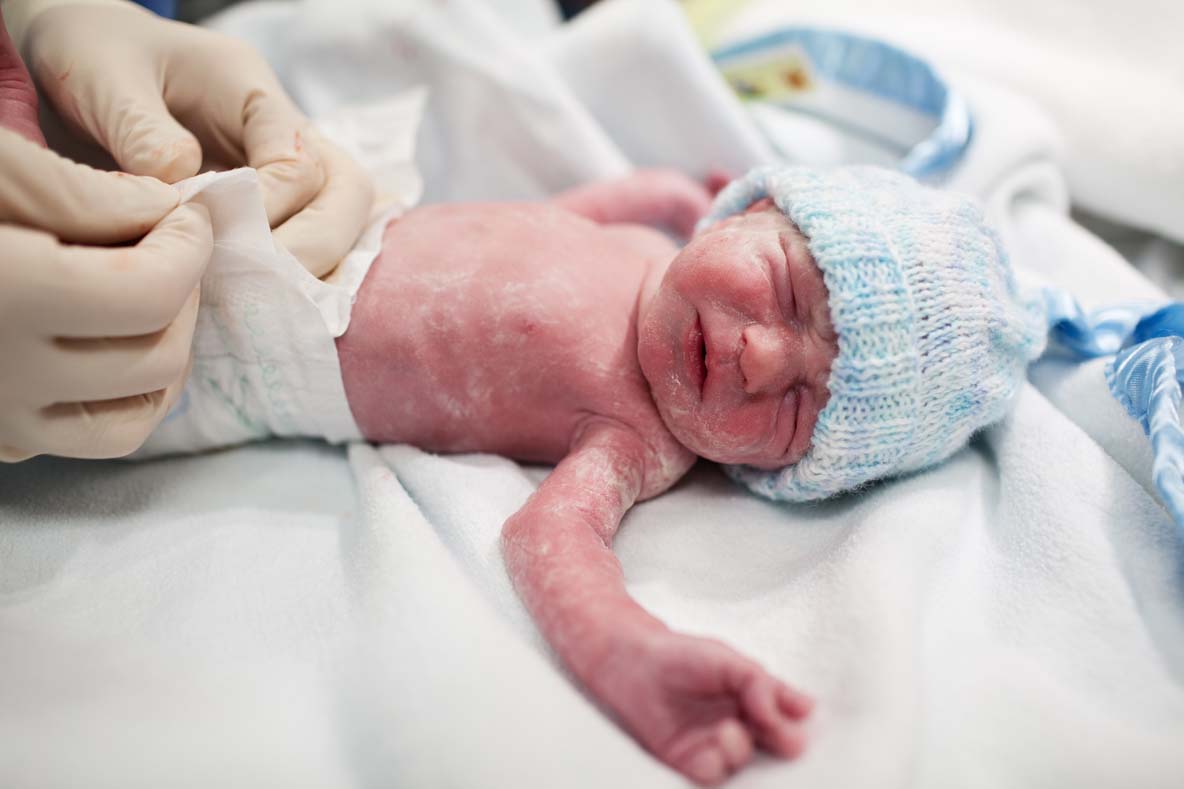 Newborn baby covered in vernix getting nappy